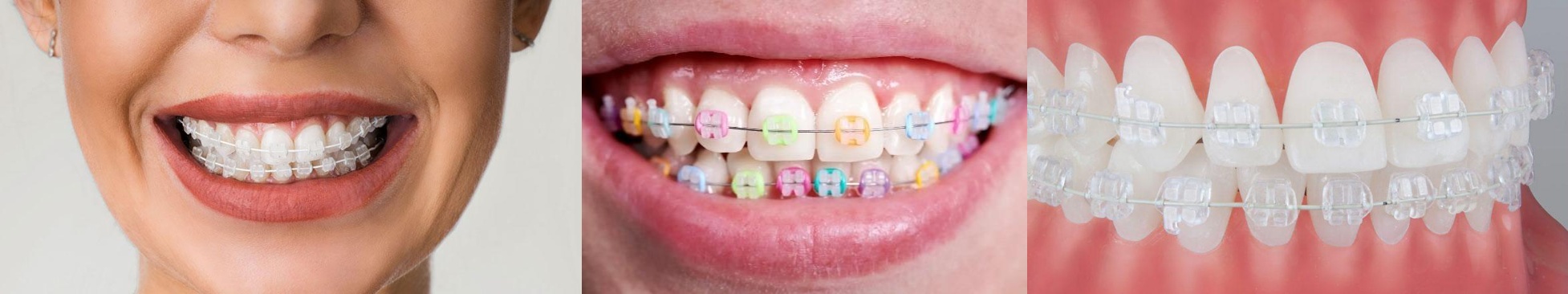 Teeth doctar in gwalior