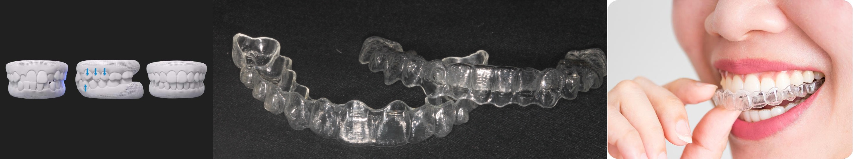 Teeth doctar in gwalior