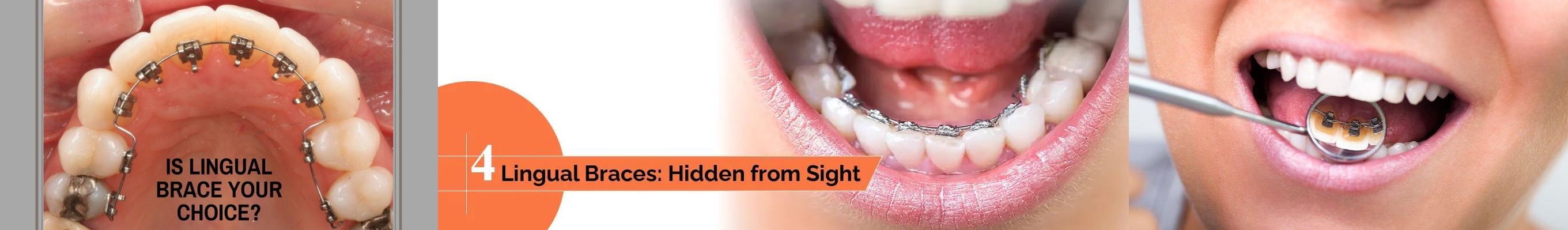Teeth doctar in gwalior