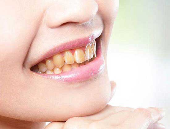 Orthodontic treatment in Gwalior