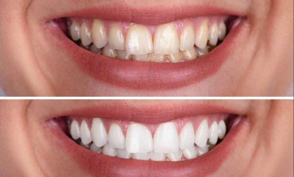 Best teeth doctar in gwalior